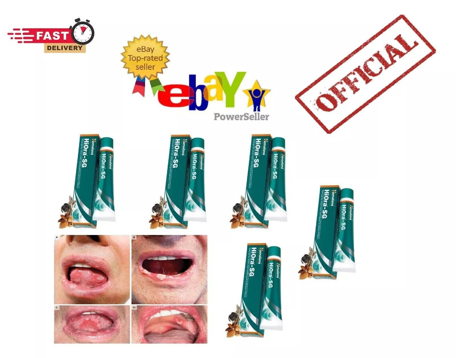 Himalaya Hiora-SG Gel For Mouth Ulcers Very Fast Free Delivery