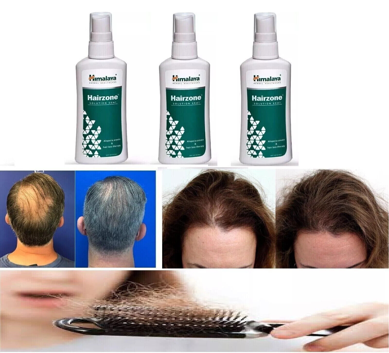 HIMALAYA HAIRZONE SOLUTION OIL 60ML PREVENTS HAIR FALL,PROMOTES HAIR GROWTH
